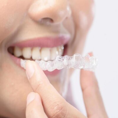 3 Reasons to Consider Invisalign if You Have a Wonky Smile