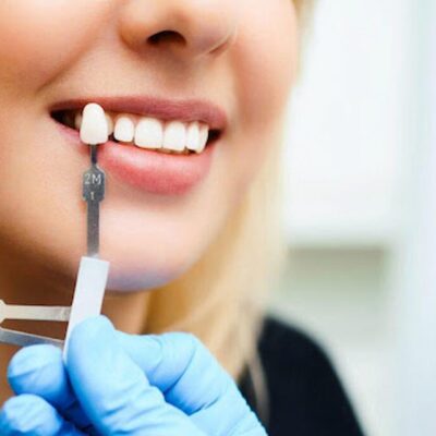 Dental Cosmetic Problems and Ways to Fix Them