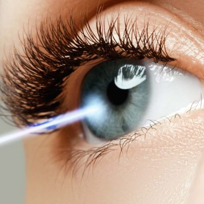 Plastic Surgery 101: Eye Surgery