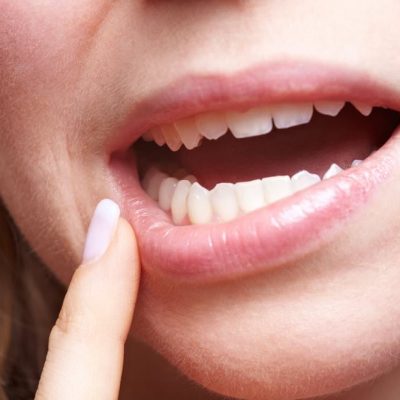 The Four-Stage Process To Gum Disease (And How You Can Prevent It)