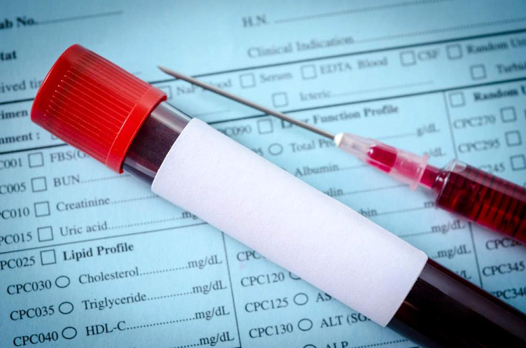 Do You Need To Get Your Cholesterol Checked? - Global Health Blog