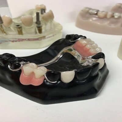 What Are Complete Dentures and False Teeth?