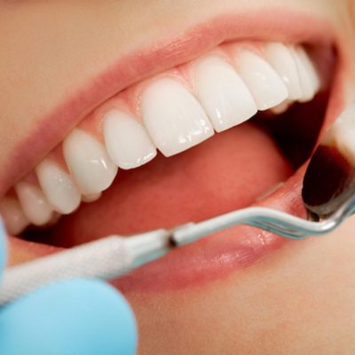 Top 5 Most Common Dental Procedures