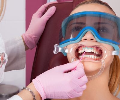 Teeth Whitening At Whiteteethwhiteningkits.Co.UK