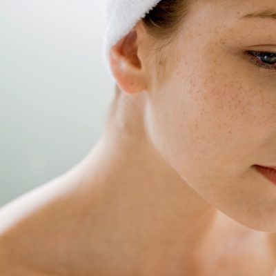 What Are The Best Natural Remedies To Get Rid Of White Sunspots On Face?